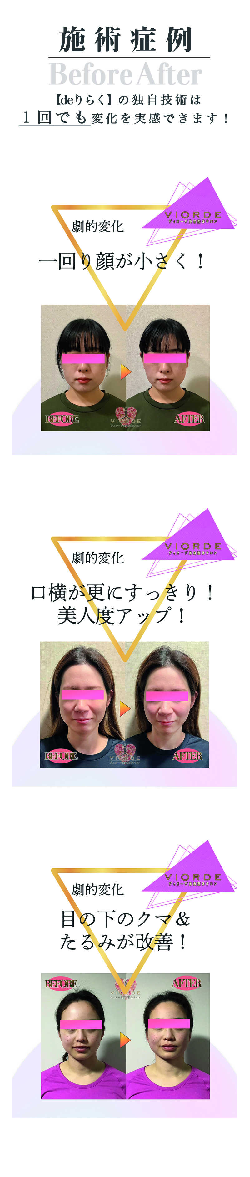 beforeafterの写真